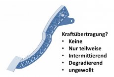 Bestimmung potenzieller Fehler im Rahmen einer FMEA, beipielsweise für ein Kupplungspedal